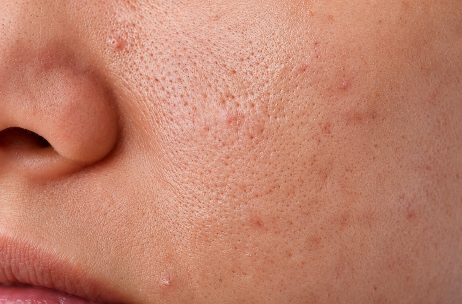 How to Improve Uneven Skin Tone: Causes, Tips & Daily Skincare Routine